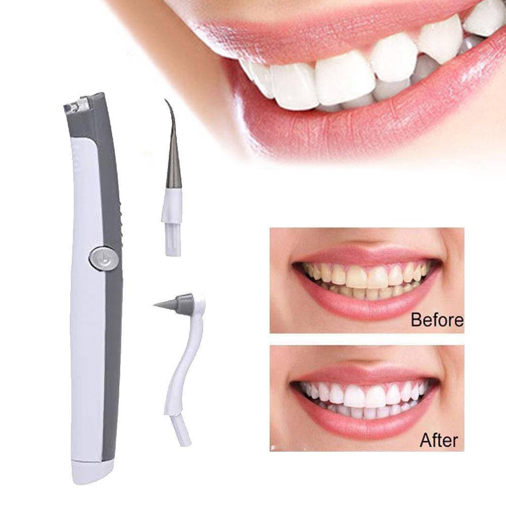 Sonic Scaler Ultrasonic Tooth Stain/Plaque Remover