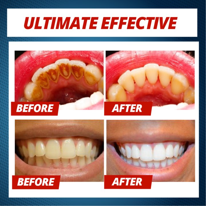 Natural Intensive Stain Remover Whitening Toothpaste